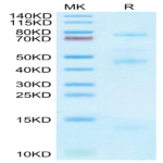 Human GARP&Latent TGF Beta 2 Complex Protein (GAT-HM402)