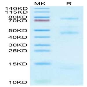Human GARP&Latent TGF Beta 2 Complex Protein (GAT-HM402)
