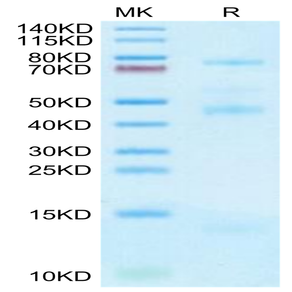 Human GARP&Latent TGF Beta 2 Complex Protein (GAT-HM402)