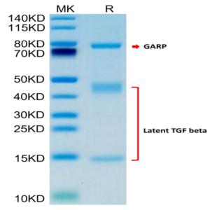 Human GARP (Y137H&S138G&G139N) &Latent TGF Beta 1 Complex Protein (GAT-HM405)