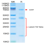 Mouse GARP&Latent TGF beta 1 Complex Protein (GAT-MM101)