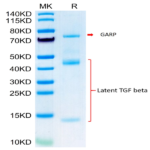 Biotinylated Mouse GARP&Latent TGF beta 1 Complex Protein (GAT-MM401B)