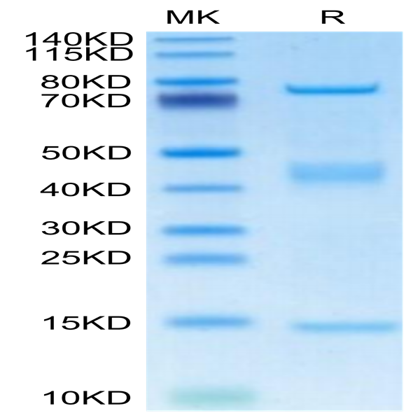 Rat GARP&Latent TGF Beta 1 Complex Protein (GAT-RM401)