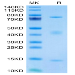 Biotinylated Rat GARP&Latent TGF Beta 1 Complex Protein (GAT-RM401B)