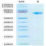 Human GBA/glucocerebrosidase Protein (GBA-HM101)