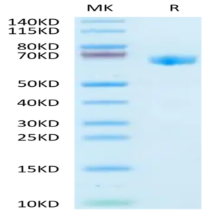 Human GBA/glucocerebrosidase Protein (GBA-HM101)