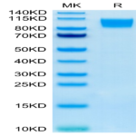 Human GUCY2C/Guanylyl cyclase C Protein (GCC-HM201)