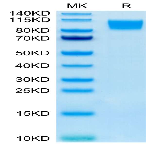 Human GUCY2C/Guanylyl cyclase C Protein (GCC-HM201)