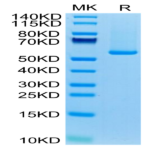 Biotinylated Human GUCY2C/Guanylyl cyclase C Protein (GCC-HM401B)