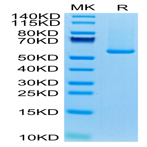 Biotinylated Human GUCY2C/Guanylyl cyclase C Protein (GCC-HM401B)