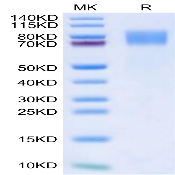 Biotinylated Mouse GUCY2C/Guanylyl cyclase C Protein (GCC-MM401B)