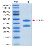 Human GDF15 Protein (GDF-HM215)