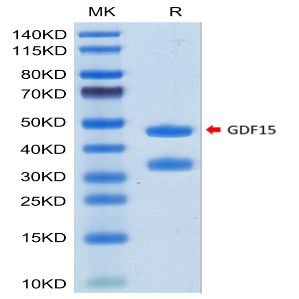 Biotinylated Human GDF15 Protein (Primary Amine Labeling) (GDF-HM215B)