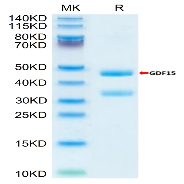 Biotinylated Mouse GDF15 Protein (Primary Amine Labeling) (GDF-MM215B)