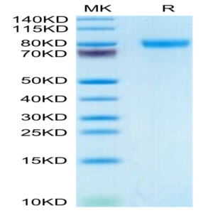 Human GEP Protein (GEP-HM101)