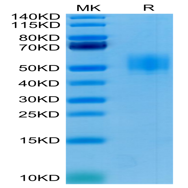 Human GFRAL/GFR alpha-like Protein (GFL-HM401)