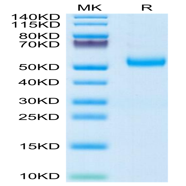 Human GFRA3 Protein (GFR-HM1A3)