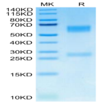 Human GGT1 Protein (GGT-HM101)