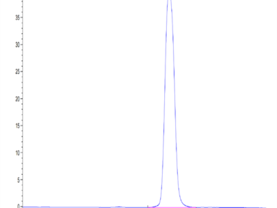 Human GHR/Growth Hormone R Protein (GHR-HM101)