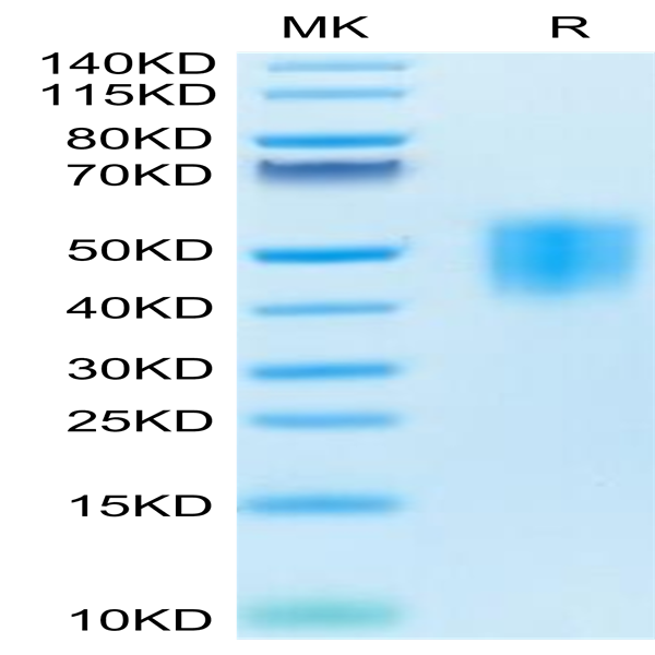 Human GHR/Growth Hormone R Protein (GHR-HM101)