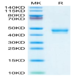 Human GIP Protein (GIP-HM201)