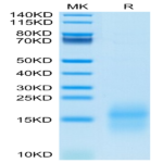 Mouse GIP Protein (GIP-MM101)