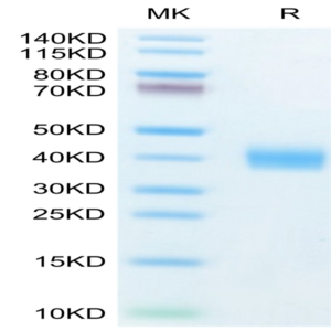 Human Galectin 3 Protein (GLT-HM103)