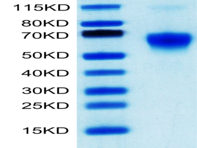 Human Galectin 9/LGALS9 Protein (GLT-HM109)