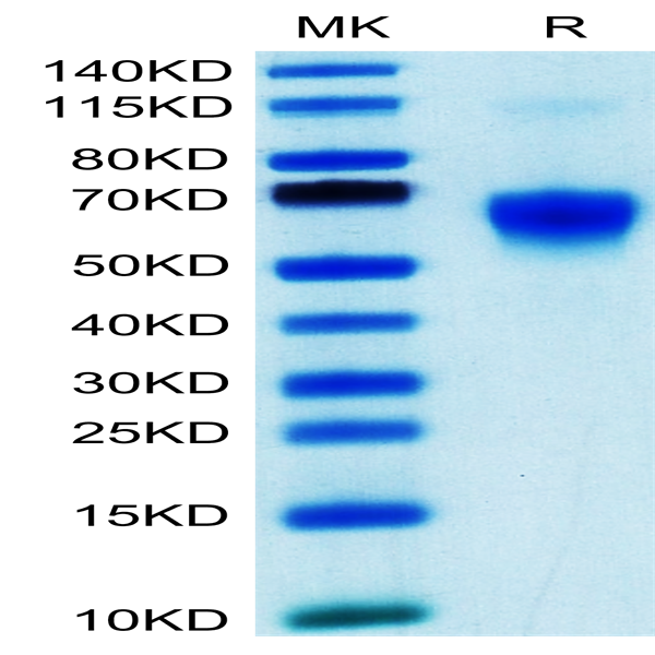 Human Galectin 9/LGALS9 Protein (GLT-HM109)
