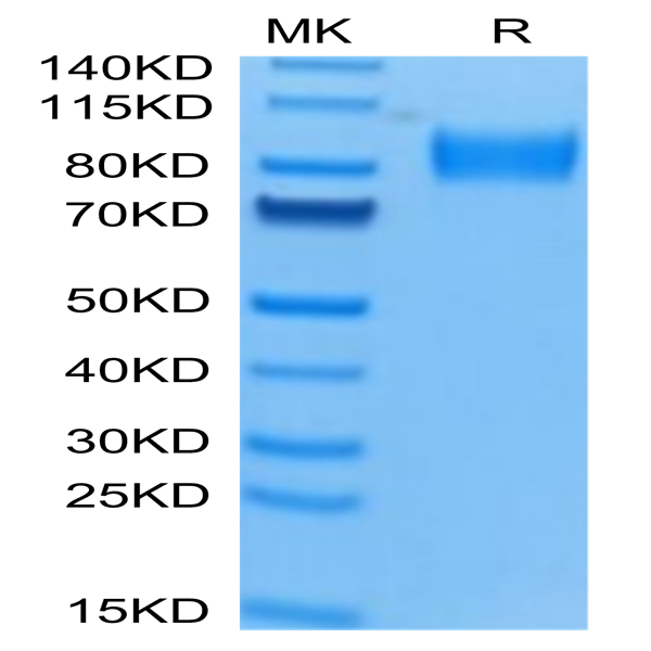 Human Osteoactivin/GPNMB Protein (GNB-HM101)