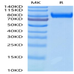 Rhesus macaque gp130/CD130/IL-6 R beta Protein (GP1-RM130)
