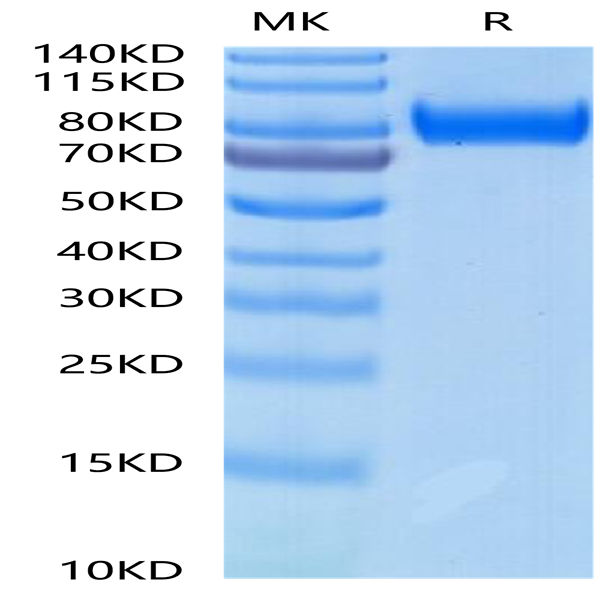 Rhesus macaque gp130/CD130/IL-6 R beta Protein (GP1-RM130)