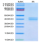 Mouse GPA33/A33 Protein (GPA-MM133)