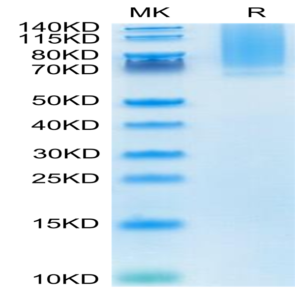 Human Glypican 1/GPC1 Protein (GPC-HM111)