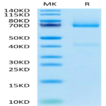 Biotinylated Human GPC3/Glypican 3 Protein (GPC-HM431B)