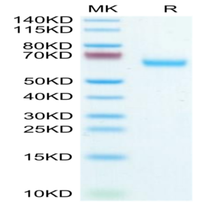 Mouse Glypican 1/GPC1 Protein (GPC-MM111)