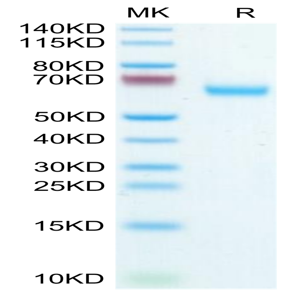 Mouse Glypican 1/GPC1 Protein (GPC-MM111)