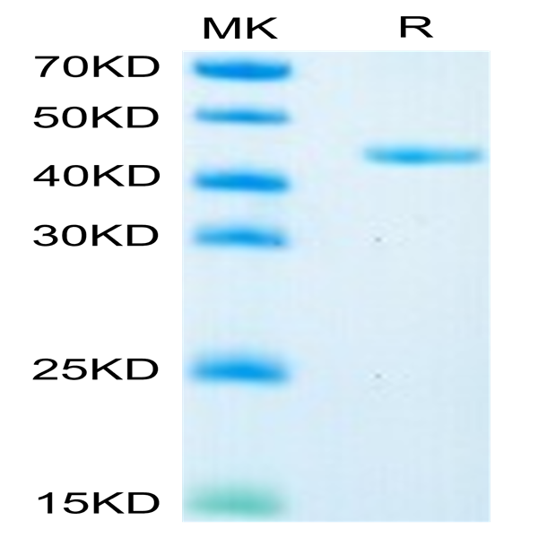 Mouse Glypican 2/GPC2 Protein (GPC-MM121)