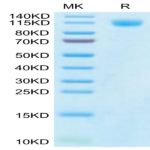 SARS-CoV-2 Spike S1 (Gamma P.1/P.1.1/P.1.2) Protein (GPS-VM1S1)