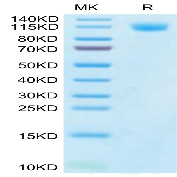 SARS-CoV-2 Spike S1 (Gamma P.1/P.1.1/P.1.2) Protein (GPS-VM1S1)