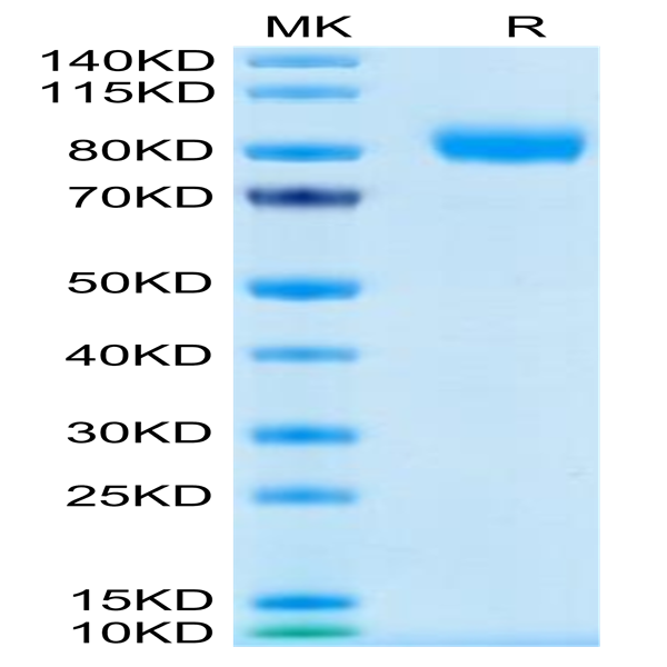 Human GM-CSF R alpha Protein (GSF-HM2RA)