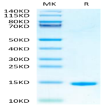Mouse GM-CSF Protein (GSF-ME001)