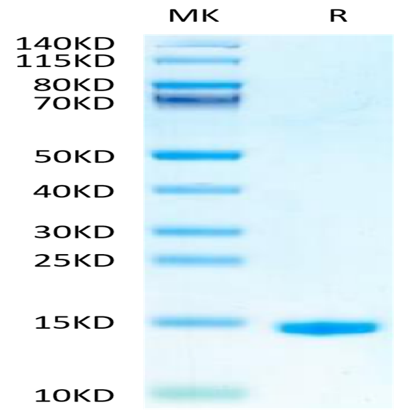 Mouse GM-CSF Protein (GSF-ME001)