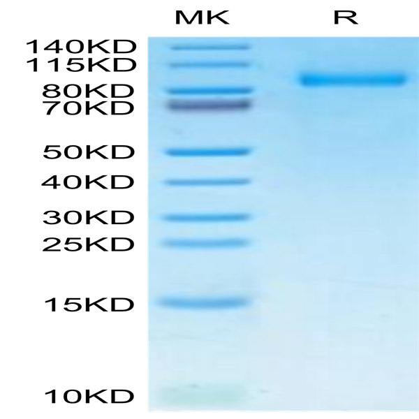 Human G-CSF R/CD114 Protein (GSR-HM101)
