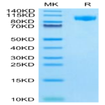 Mouse G-CSF R/CD114 Protein (GSR-MM101)