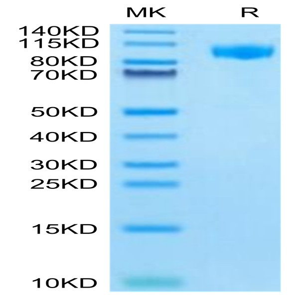 Mouse G-CSF R/CD114 Protein (GSR-MM101)