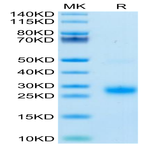 Biotinylated Human GITR/TNFRSF18 Protein (GTR-HM401B)