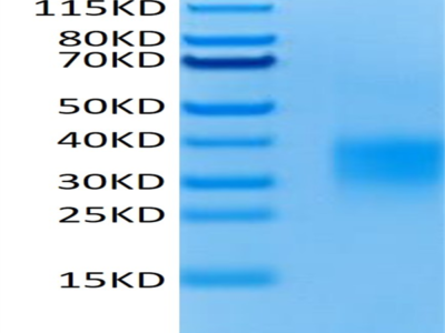 Mouse GITR/TNFRSF18 Protein (GTR-MM101)