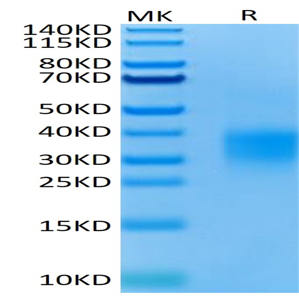 Mouse GITR/TNFRSF18 Protein (GTR-MM101) Mouse GITR/TNFRSF18 Protein (GTR-MM101)