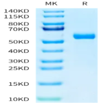 Human HAI-1 Protein (HAI-HM11A)